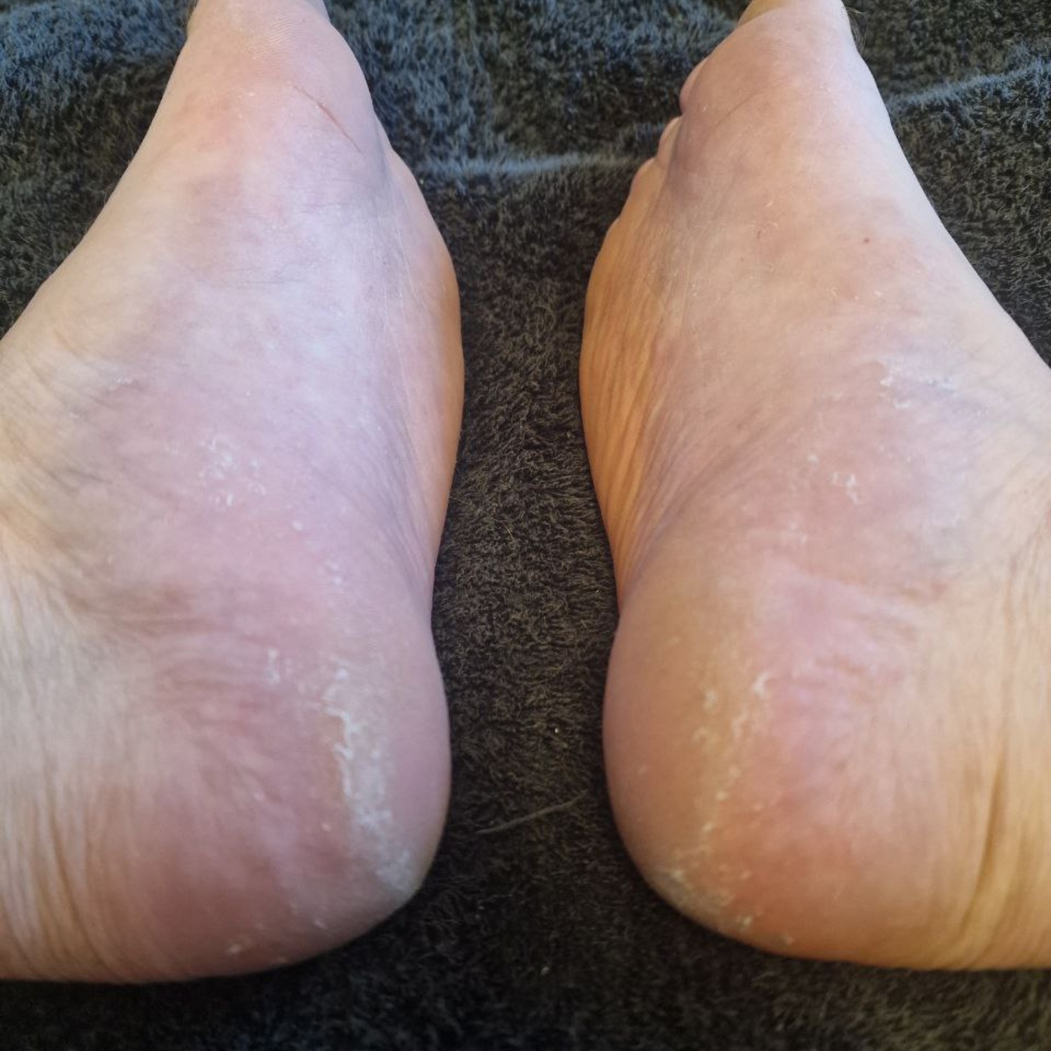 Why Foot Care Matters After 30 – Even More After 40